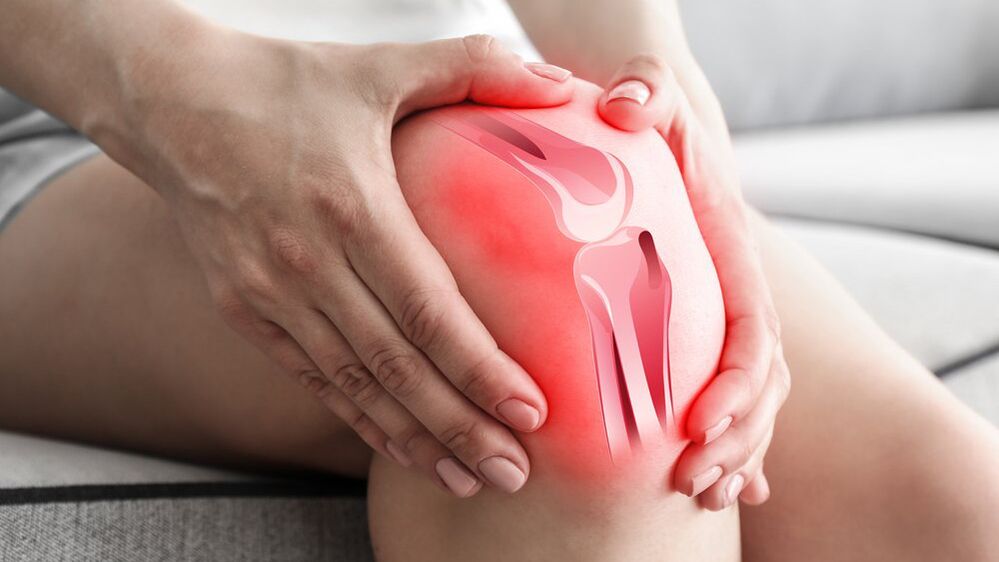 Tratamiento para el dolor articular Osteflex